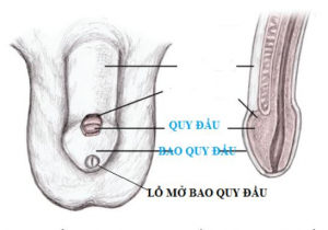 Hẹp bao quy đầu sinh lý và bệnh lý